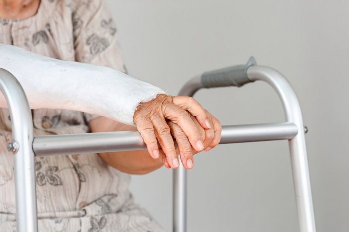 Переломы у пожилых: как помочь возрастным пациентам